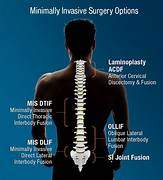 spine surgeries